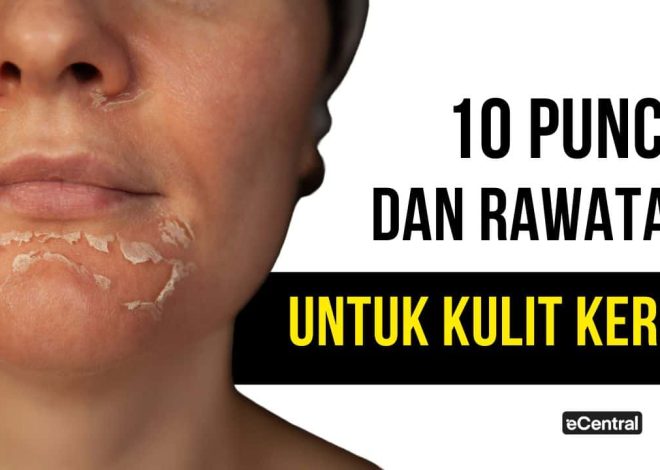 Dry skin because of what? This is Punca, how to prevent & tips on choosing a product