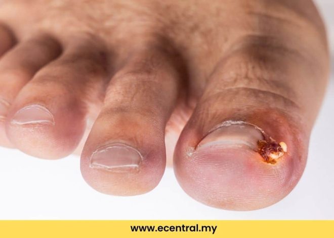 Nails don’t heal? This may be the cause