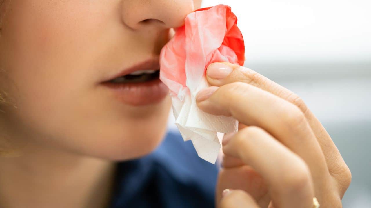 What bleeding nose should be done? This is the cause, care & prevent