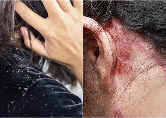 Causes, how to prevent and care